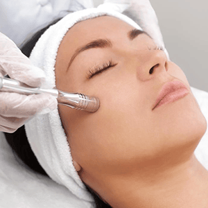 Microdermabrasion